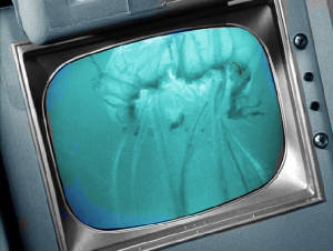 jellyfishmonitor.jpg